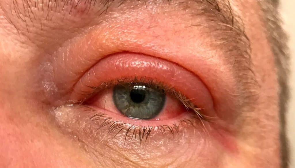 sarhosken yuzustu uyudu kor uyandi e7f6124d86a970fb440bf0e223f5989d