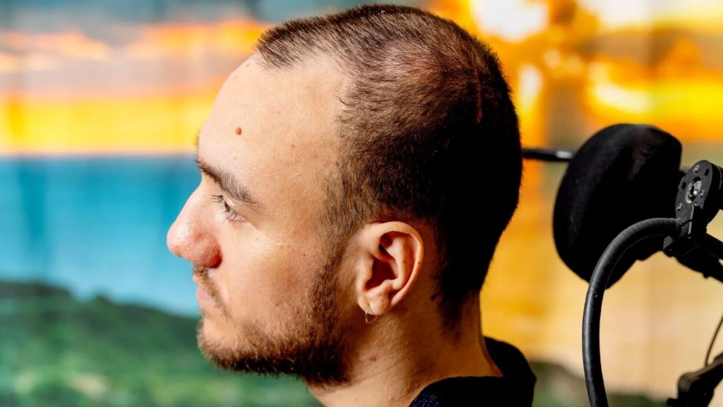 Neuralink ile beynine çip takılan ilk kullanıcıdan açıklamalar 7 neuralink ile beynine cip takilan ilk kullanicidan aciklamalar QDJgvCrO
